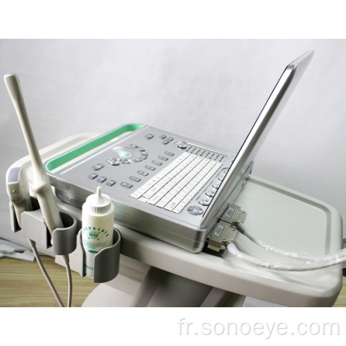 Scanner à ultrasons pour ordinateur portable SS-9 Sonostar